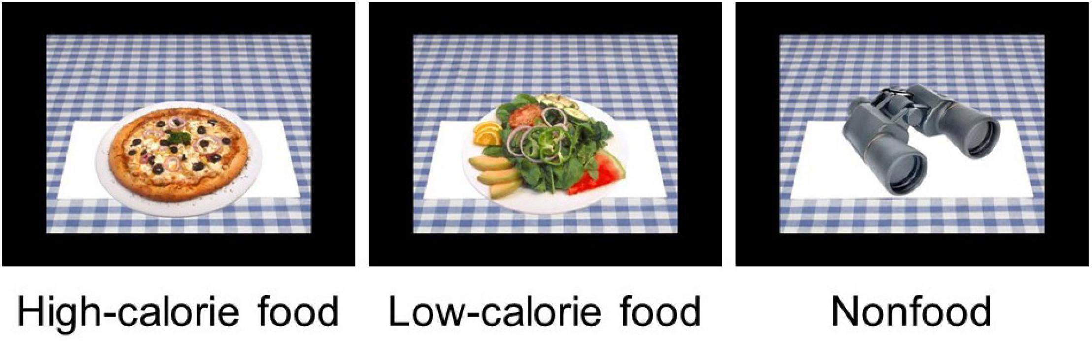 Spatiotemporal profile of altered neural reactivity to food images in obesity: Reward system is altered automatically and predicts efficacy of weight loss intervention